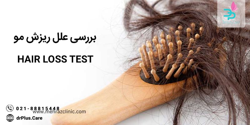 آزمایش علت ریزش مو چگونه انجام میشود ؟